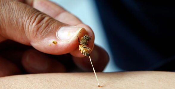 bee venom